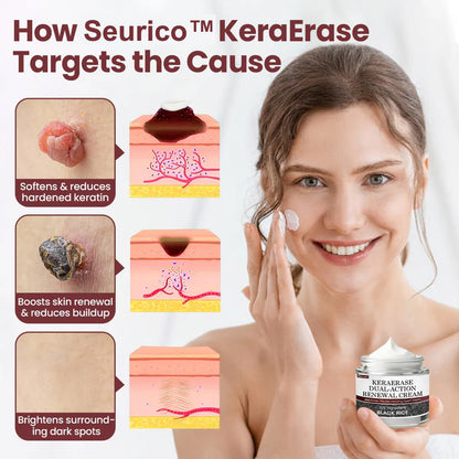 Seurico™KeraErase Dual-Action Renewal Cream